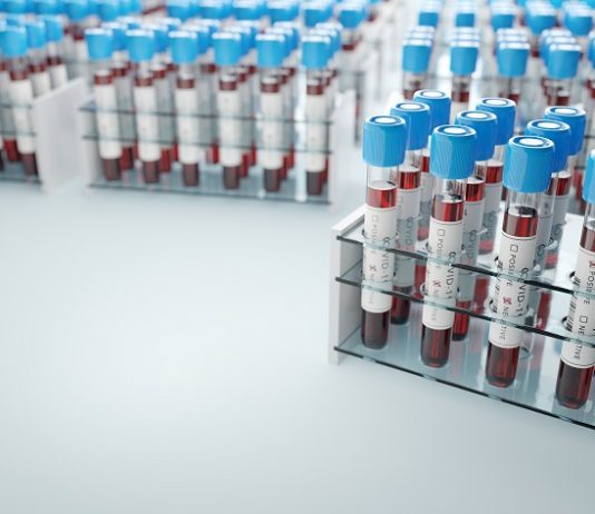 Nápolyban orvosokat keresnek – sokan félelmükben rohannak a sürgősségi osztályokra