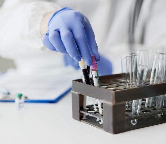 A világ egyik legnagyobb gyógyszergyártója megbukott oltóanyagfejlesztésből