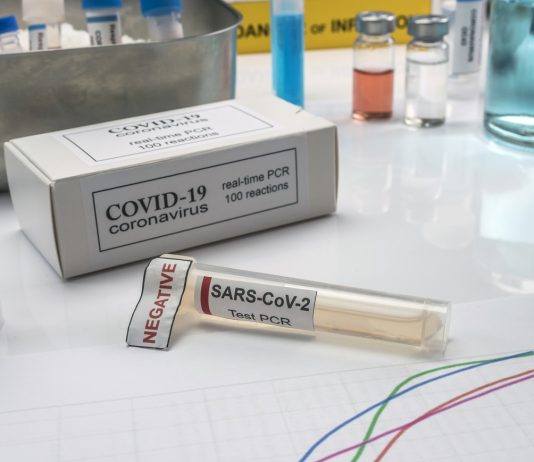 Péntek helyett hétfőtől kell negatív tesztet felmutatniuk az Angliába utazóknak