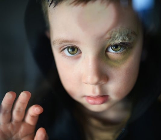 Szolgasorban tartotta és munkára kényszerítette nevelt gyermekeit egy házaspár