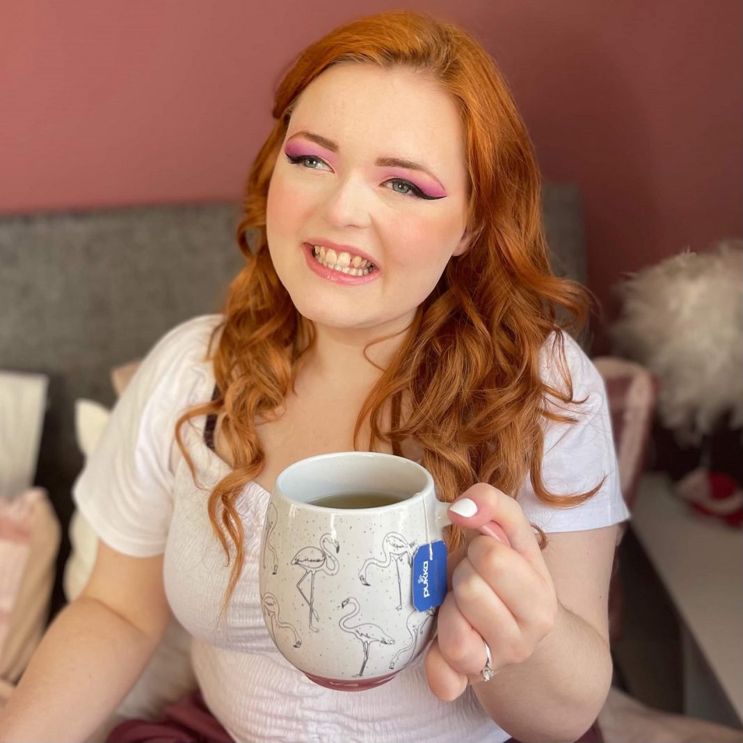 “Vak vagyok és sikeres. A fogyatékosságom, a karrierem és én” Lucy Edwards