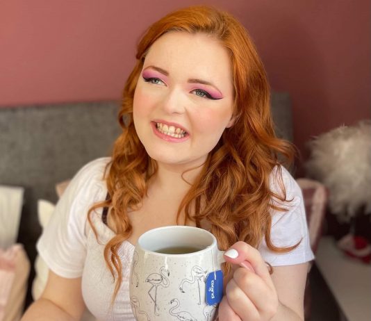 “Vak vagyok és sikeres. A fogyatékosságom, a karrierem és én” Lucy Edwards